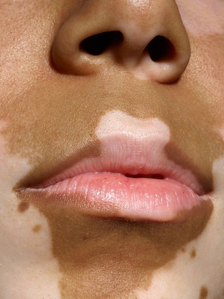 Face