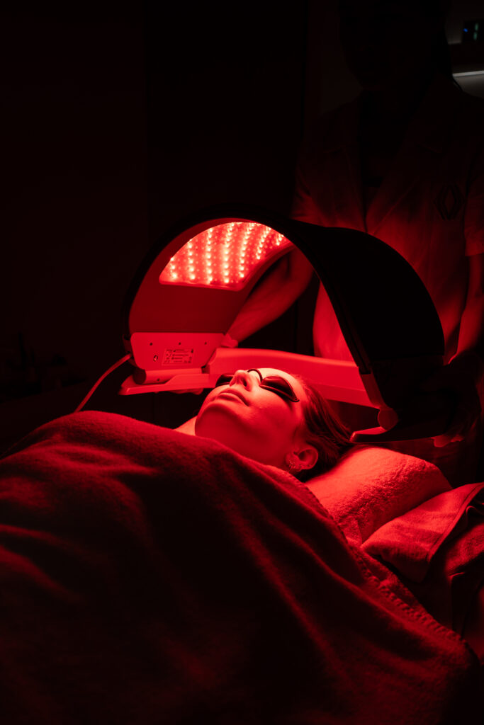 Pigmentation Treatment in Bali | Mello Spa Seminyak